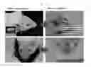 Fig. 16 - Method for preparing chondrocytes