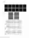 Fig. 17 - Induction of motor neurons from pluripotent stem cells