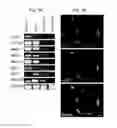 Fig. 09 - Generation of inner ear auditory hair cell