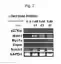 Fig. 11 - Generation of inner ear auditory hair cell