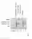 Fig. 02 - Factor X activation