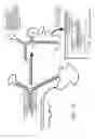 Fig. 13 - Signal activated RNA interference