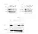 Fig. 02 - Small interference RNA for inhibiting intracellular expression of ribosomal protein S3