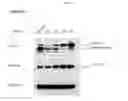 Fig. 03 - Small interference RNA for inhibiting intracellular expression of ribosomal protein S3
