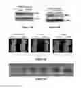 Fig. 18 - Materials and Methods Useful For Affecting Tumor Cell Growth, Migration and Invasion