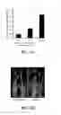 Fig. 40 - P-coumaroyl-CoA:monolignol transferase