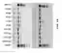 Fig. 41 - COMPOSITIONS AND METHODS OF NUCLEIC ACID-TARGETING NUCLEIC ACIDS
