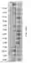 Fig. 55 - COMPOSITIONS AND METHODS OF NUCLEIC ACID-TARGETING NUCLEIC ACIDS