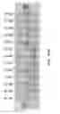 Fig. 58 - COMPOSITIONS AND METHODS OF NUCLEIC ACID-TARGETING NUCLEIC ACIDS
