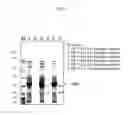 Fig. 02 - DNA encoding novel enzyme having D-serine synthase activity, method of producing the enzyme and method of producing D-serine by using the same