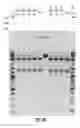 Fig. 27 - Compostions and methods of nucleic acid-targeting nucleic acids