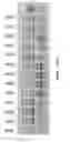 Fig. 55 - Compostions and methods of nucleic acid-targeting nucleic acids