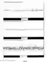 Fig. 17 - Common and rare genetic variations associated with common variable immunodeficiency (CVID) and methods of use thereof for the treatment and diagnosis of the same