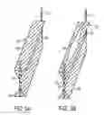 Fig. 07 - METAL PLATING SYSTEM INCLUDING GAS BUBBLE REMOVAL UNIT