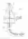 Fig. 03 - Drill string sub