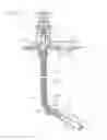 Fig. 06 - Wellbore drilling using dual drill string