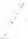 Fig. 02 - Downhole apparatus