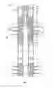 Fig. 02 - Barrier device with fluid bypass for multi-zone wellbores