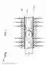 Fig. 04 - Wellbore Plug Isolation System and Method