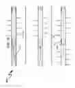 Fig. 33 - Wellbore plug isolation system and method