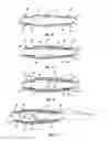 Fig. 04 - Expandable packer methods
