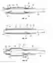 Fig. 05 - Expandable packer methods