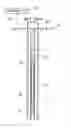 Fig. 01 - Wellbore flowmeter