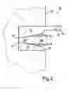 Fig. 03 - Apparatus and method for securing sealing elements