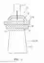 Fig. 04 - Smart active clearance control between a rotor blade and a shroud