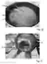 Fig. 17 - Apparatus and Method for Preventing and Removing Carbon Deposits