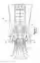 Fig. 02 - FUEL INJECTOR ASSEMBLIES IN COMBUSTION TURBINE ENGINES