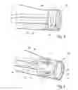 Fig. 04 - ROTOR BLADE OF A WIND TURBINE