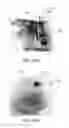 Fig. 24 - Durable canted off-axis driver for quiet pneumatic pumping