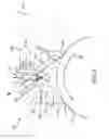 Fig. 05 - Bi-directional clutch lock
