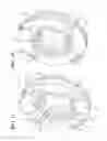 Fig. 11 - Brake rotor assembly
