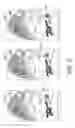 Fig. 04 - Translucent object having housing, cavities and controller forming facial expressions
