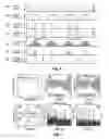 Fig. 04 - PHASE-INVERTED SIDELOBE-ANNIHILATED OPTICAL COHERENCE TOMOGRAPHY
