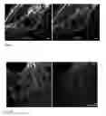 Fig. 05 - Fluorescent dyes with phosphorylated hydroxymethyl groups and their use in light microscopy and imaging techniques