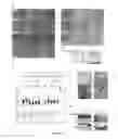 Fig. 03 - METHODS TO OBTAIN A NOVEL CLASS OF GRAM NEGATIVE BACTERIA ANTIBIOTICS WHICH TARGET AN UNKNOWN CELL DIVISION ASSOCIATED PROTEIN LOP1