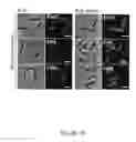Fig. 17 - METHODS TO OBTAIN A NOVEL CLASS OF GRAM NEGATIVE BACTERIA ANTIBIOTICS WHICH TARGET AN UNKNOWN CELL DIVISION ASSOCIATED PROTEIN LOP1