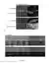 Fig. 18 - METHODS TO OBTAIN A NOVEL CLASS OF GRAM NEGATIVE BACTERIA ANTIBIOTICS WHICH TARGET AN UNKNOWN CELL DIVISION ASSOCIATED PROTEIN LOP1