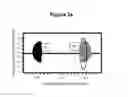 Fig. 03 - METHOD FOR DIAGNOSING VAGINAL INFECTIONS