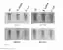 Fig. 04 - COMPOSITIONS AND METHODS FOR DETECTION OF A TARGET IN A MOLECULAR ASSAY USING PH CHANGES
