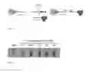 Fig. 16 - COMPOSITIONS AND METHODS FOR DETECTION OF A TARGET IN A MOLECULAR ASSAY USING PH CHANGES