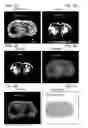Fig. 06 - Combined DESI and optical imaging analysis of tissues