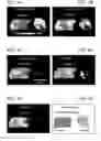 Fig. 07 - Combined DESI and optical imaging analysis of tissues