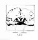 Fig. 15 - MAGNETIC-RESONANCE IMAGE DIAGNOSTIC APPARATUS AND METHOD OF CONTROLLING THE SAME