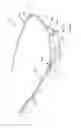 Fig. 17 - Interchangeable eyewear/head-mounted device assembly with quick release mechanism