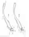 Fig. 22 - Interchangeable eyewear/head-mounted device assembly with quick release mechanism