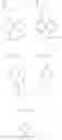 Fig. 11 - Positive resist composition and patterning process